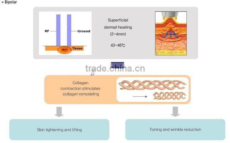 portable RF machine/rf/ rf skin tightening machine