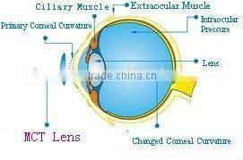 Digital Rigid contact lens for corneal reshape / MCT/ Luxuriant metamorphosis of RGP Lenses