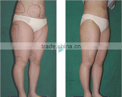 Factory Price Ultrasonic Cavitation Beauty Machine F017 for Weight Lost