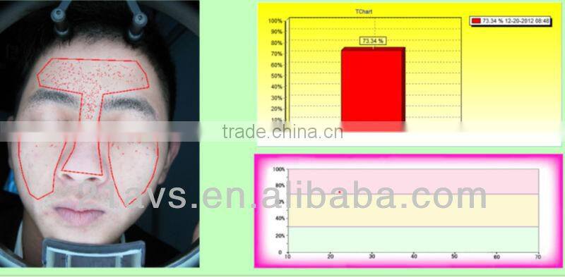 Professional Facial Skin Analyzer Magic Mirror with software system for beauty salon