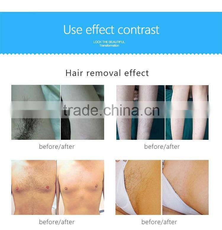 2016 Simply & easy operation Ipl + e-light+ SHR 3 in 1 Mini Hair removal beauty machine in cheap price ipl shr SR HR factory