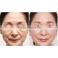 The factory price Photon Skin Rejuvenation cavitation gel vacuum rf for salon use