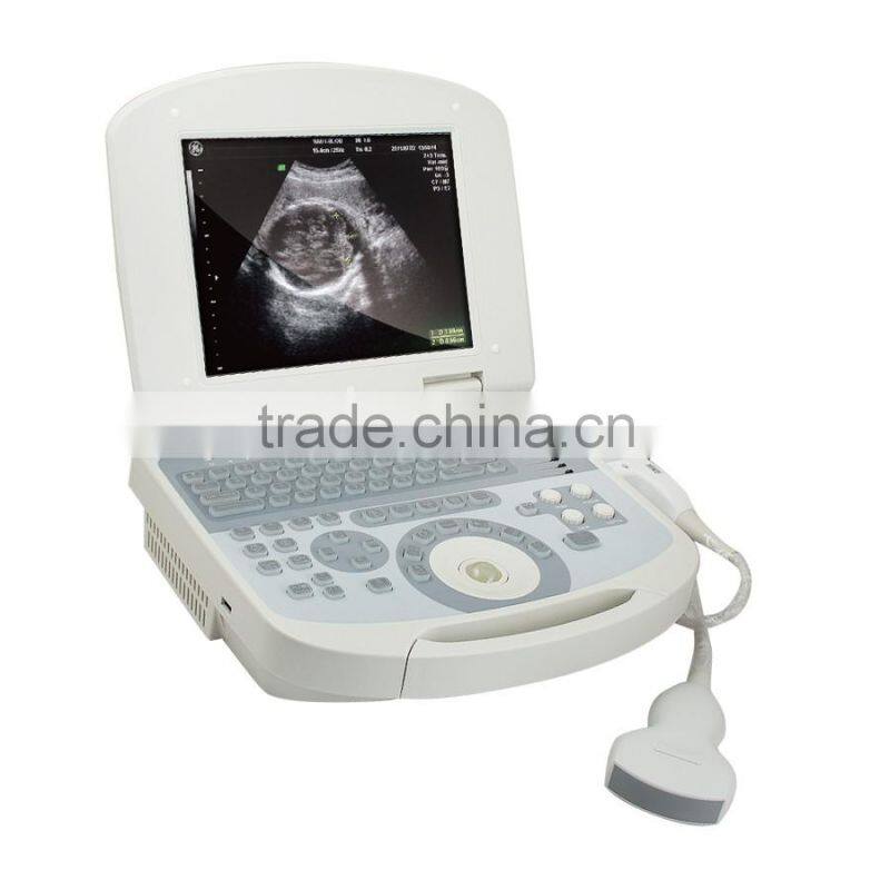 New hot selling portable ultrasound scanner / ultrasound machine suitable clinic community
