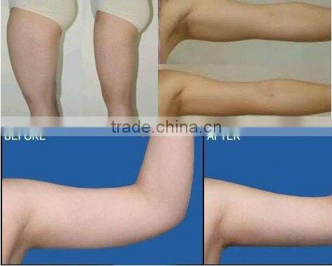 2016 Latest Cavitation Body shaping Beauty Equipment