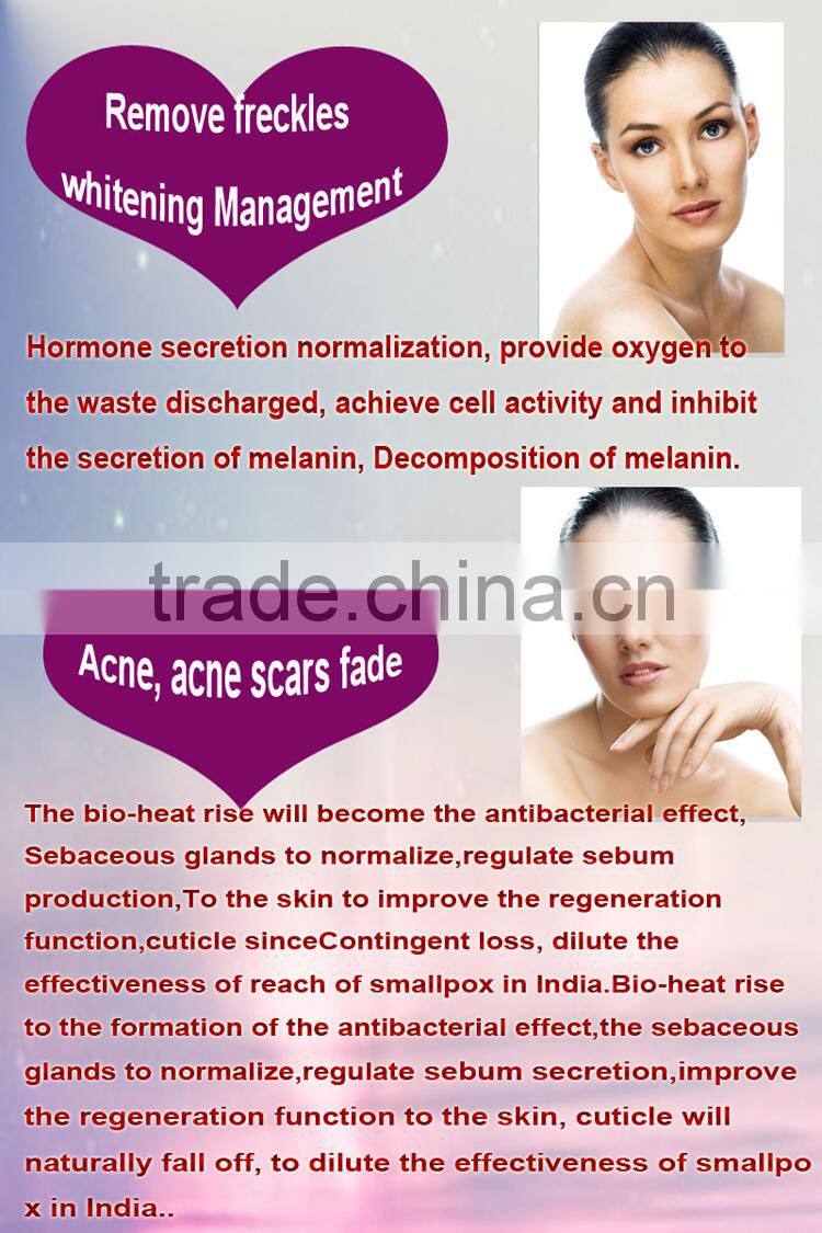 RF Radio frequency rf lifting skin tightening face beauty rf machine