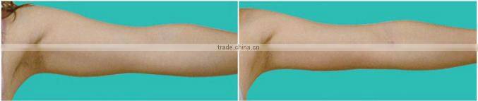 alibaba shuoyang arm slimming belt