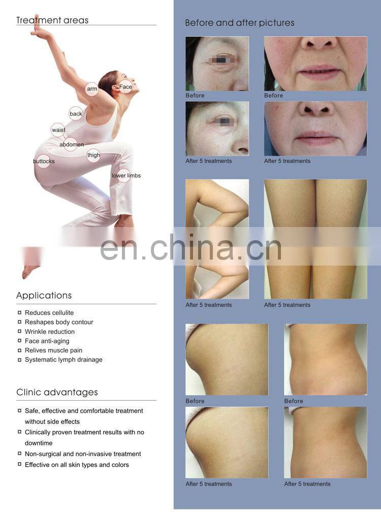 2015 GSD ultra lipo cavitation rf beauty slimming machine / vacuum and rf beauty equipment / body shaping system