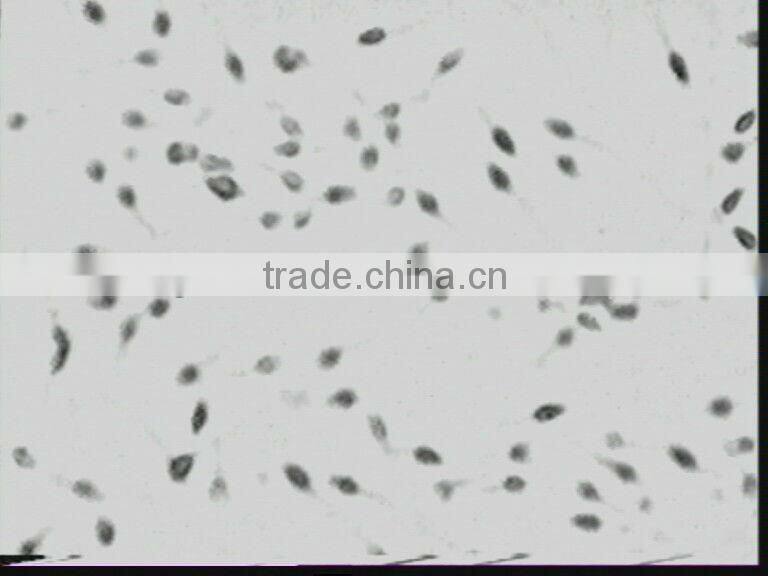 Sperm analyzer(tr-3000)