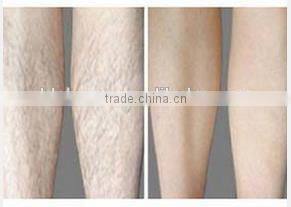 New arrival Germany Bars diode laser 808 hair remover feature for permanent hair removal