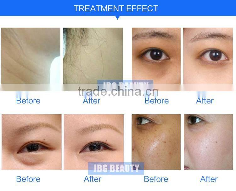 Multifunction Digital RF Biochemistry Skin Care Analyser Facial Beauty Cell Dialysis Machine