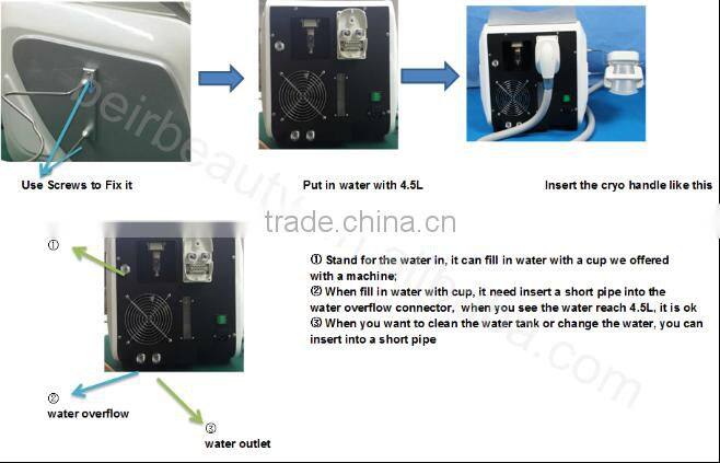 Dual cryo heads cryo lipolisis portable freezing slimming machine CTL76