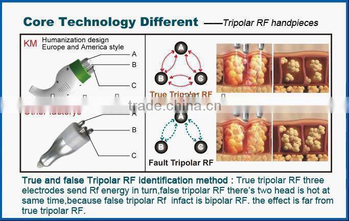 Hot sale rf machine trending hot products for loss weight