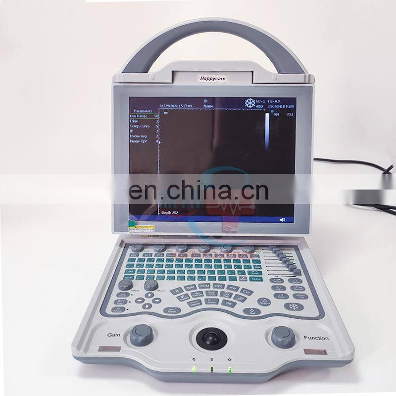 HC-A012A Cheapest portable veterinary pet Ultrasound machine full digital colour Doppler Ultrasound scanner for vet