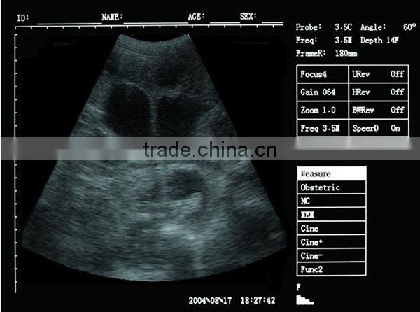 Sonostar portable cow ultrasound machine pig pregnancy ultrasound scanner pirce V5