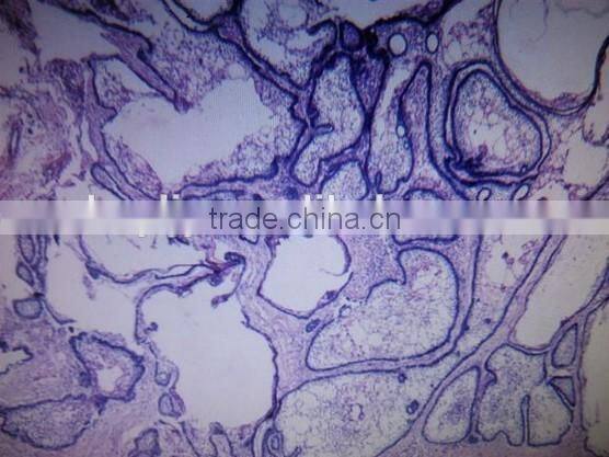 adamantoblastoma oral pathology prepared slides/teaching oral pathology slides/medical oral pathology slides