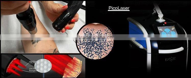 PicoSecond laser new laser for tattoo removal pigment removal