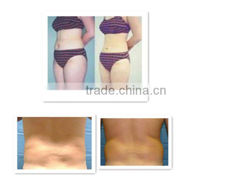 mini portable ultrasound cavitation machine