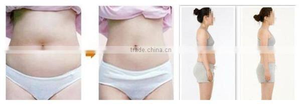 2014 best-selling multifunctional cavi/rf/vacuum beauty salon use ultra lipo cavitation+rf beauty slimming machine