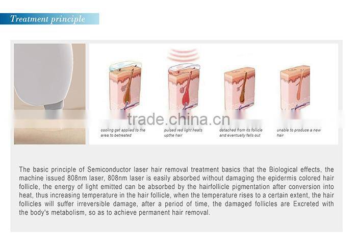 2015 hot sale ce approved 808nm laser hair removal machine alexandrite