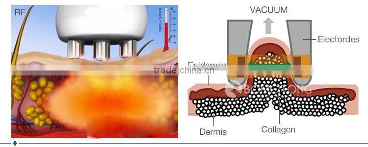 5 in 1 fast cavitation rf machine korea