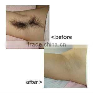 Hot sale SHR beauty equipment improve facial micro-circulation, IPL SHR hair removal beauty machine for sale - A011