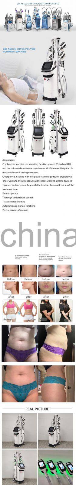Top Saleing Product 2021 Crioliplisisculpingcryolipolysis Cryo Fat Freeze Vacuum Cavitation System Equipo Criolipolisis