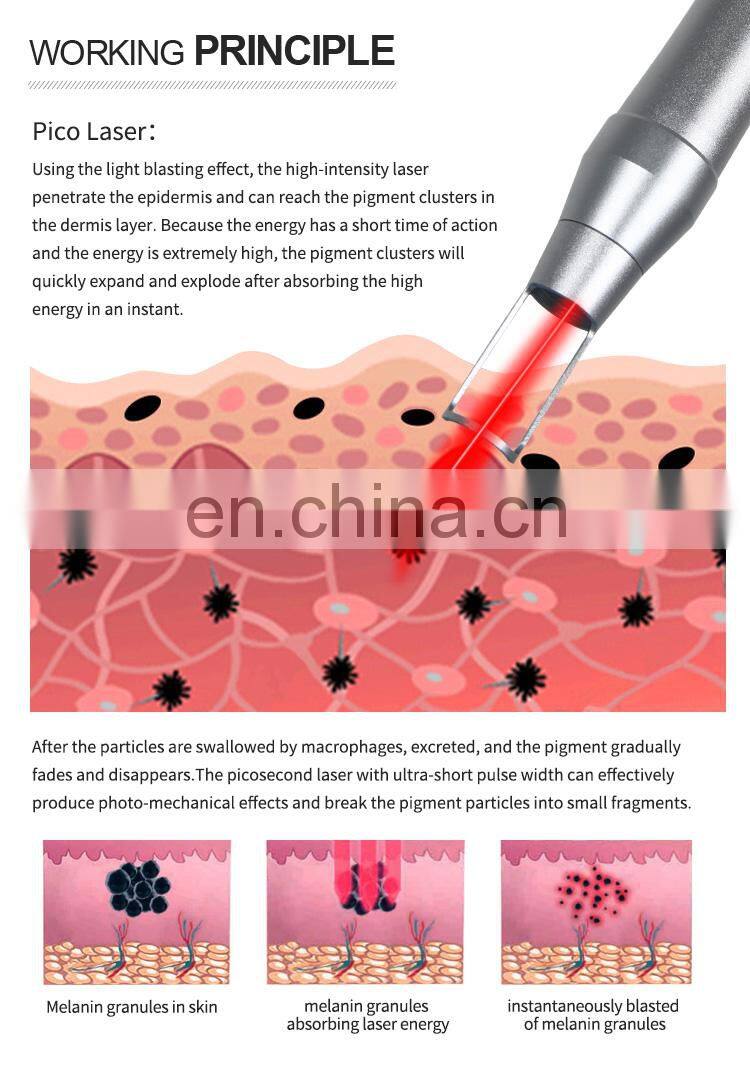 Vertical 808 diode laser therapy picosecond tattoo pigment removal hair removal machine