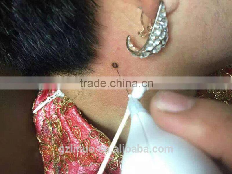 Beauty and health mole removal machine , nevus removal machine