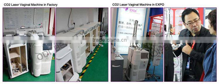 Bestsellers fractional laser co2 vaginal equipment
