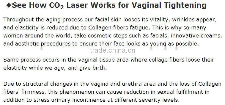 Medical equipments Fractional co2 Laser for scar removal