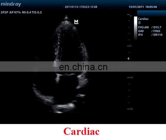 DP-7 Factory Price Mindray trolley Full digital DP-7 ultrasound machine price