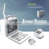 Coupon available! Ipad ultrasound scanner, touch screen scanner 3D color doppler MSLCU22-N