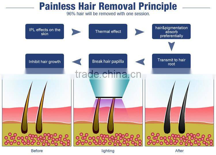 2016 best professional soprano SHR Elight ipl laser hair removal machine