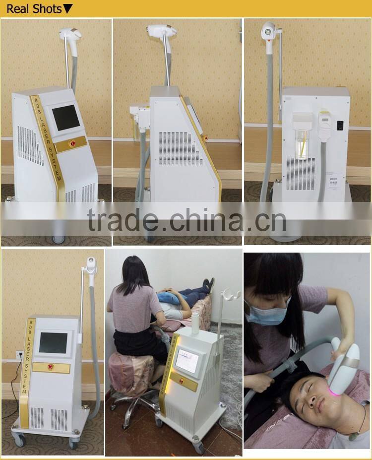 Permanent laser hair removal facial hair removal for women