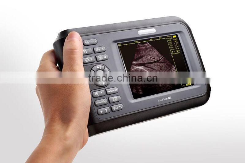 2016 Best Palm handheld ultrasound scanner ultrasound & palm ultrasound ultrasonic diagnostic insturements-V8
