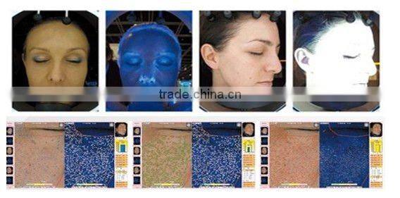 magic mirror face nalyzer with CE