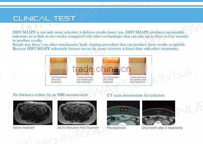 China new designed body shape slimming system hifu transducer