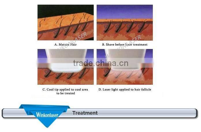 powerful and professional hair removal pad and hair removal prices