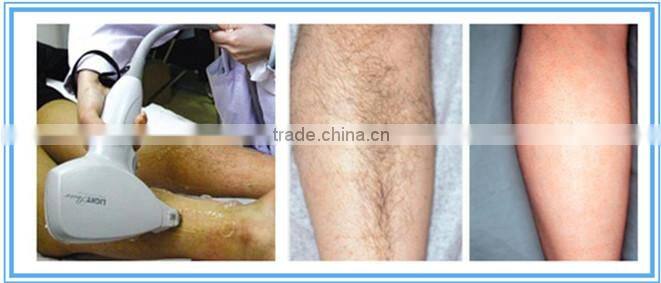 Multifunctional IPL 808nm diode laser hair removal beauty machine