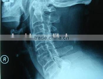 agfa /fuji x-ray equipments prices/medical clothing for china supplier