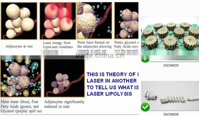 Portable Lipo Laser for fat removal equipment home use