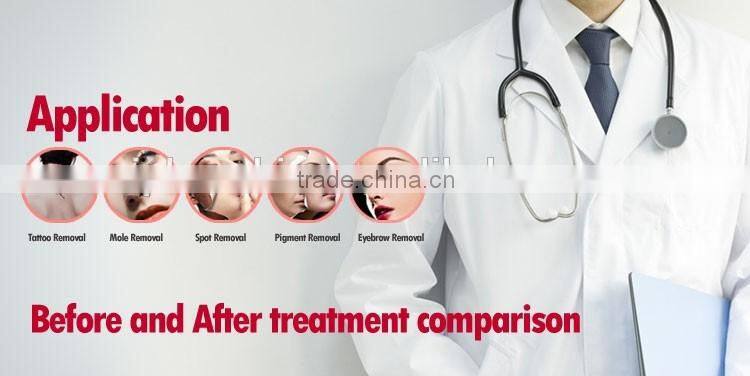 High frequency tattoo removal laser machine china laser