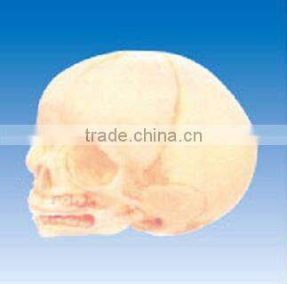 Infant skull model