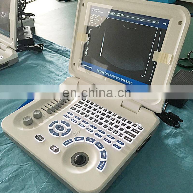 HC-A006 Black /white laptop ultrasound scanner linear probe for Clinic hospital lab