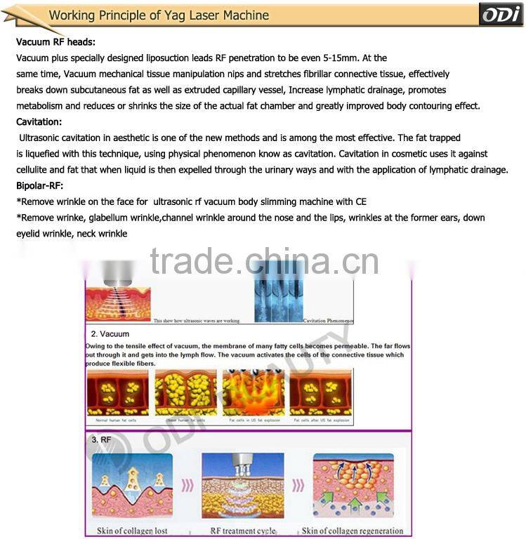 35%OFF S901 RF Vacuum ultrasonic liposuction ultrasound cavitation weight loss