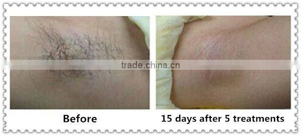 Mini home ipl hair removal machine