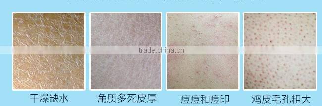 Nature extract jasmine/starwberry/lemon/blueberry/rose /pinch/aloe /vanilla Skin Whitening Shower Gel