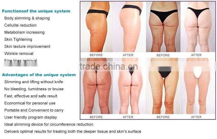 Weight Loss Equipment Rf Focused Ultrasound Slimming Machine