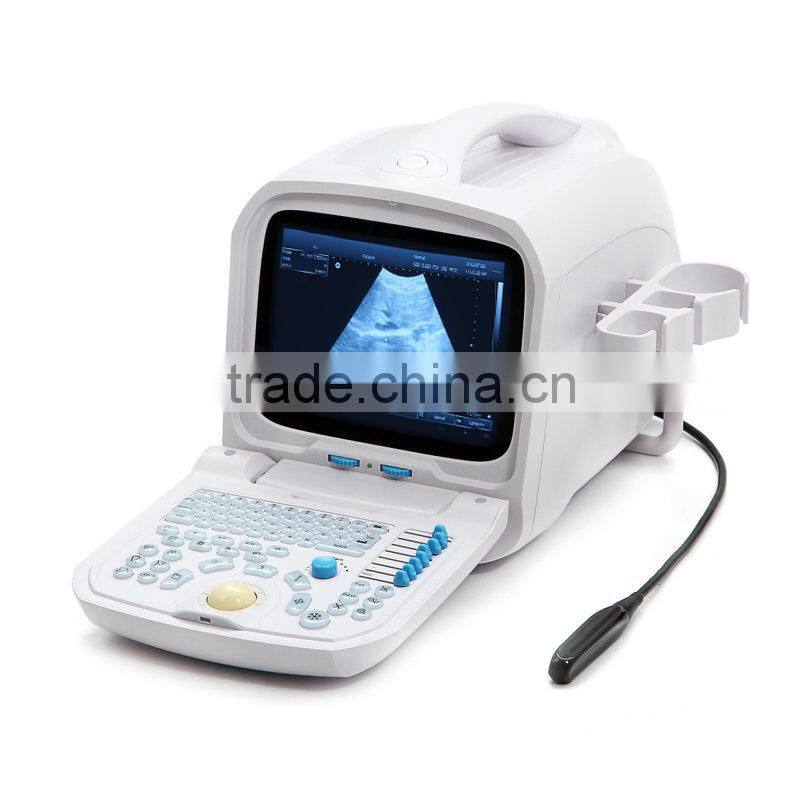 CE Mark Medical Equipment Portable ultrasonic/Cheapest ultrasounic Scanner/Machine 3.5Mhz multi-frequency Convex Probe-Shelly