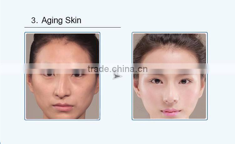 No needle mesotherapy machines skin whitening injection facial massager machine